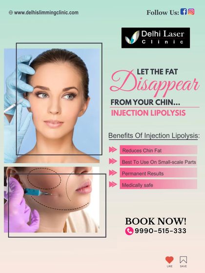 A double chin can be a frustrating area of stubborn fat. I use Injection Lipolysis, a medically safe procedure, to permanently reduce chin fat. This treatment is best for small, targeted areas and delivers visible results by dissolving fat cells.