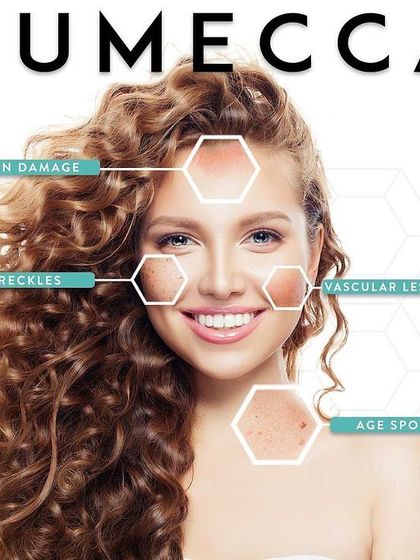 This graphic illustrates the concerns Lumecca IPL can address, including sun damage, freckles, vascular lesions, and age spots. It is a comprehensive solution for skin clarity.