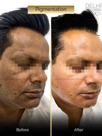 Skin Correction & Rejuvenation