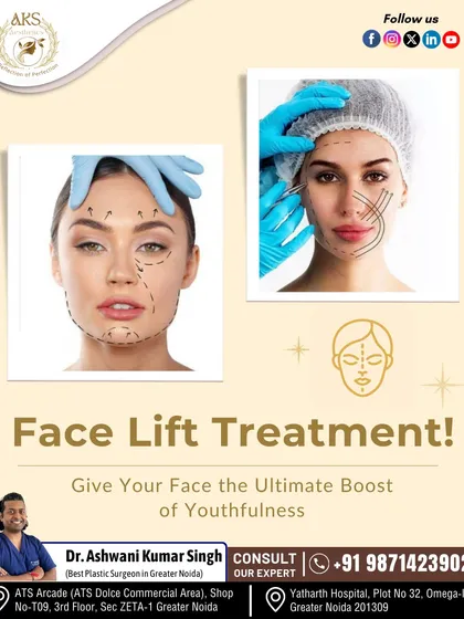 A facelift, or rhytidectomy, is designed to create a naturally refreshed and youthful appearance. This graphic illustrates the areas I address to tighten sagging skin, smooth deep creases, and restore the contours of the face and neck.