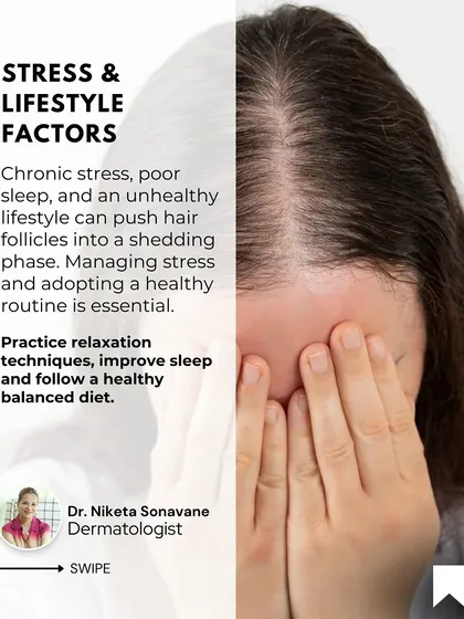 Never underestimate the impact of stress and lifestyle on your hair. Chronic stress and poor sleep can push hair follicles into a shedding phase. Managing stress, improving sleep, and eating a balanced diet are essential for healthy hair.