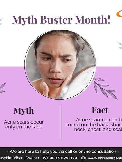 It's a myth that acne scars only appear on the face. I regularly treat scarring on the back, shoulders, chest, and neck. Acne can occur wherever you have oil glands, and my treatment plans address scars on any part of the body.