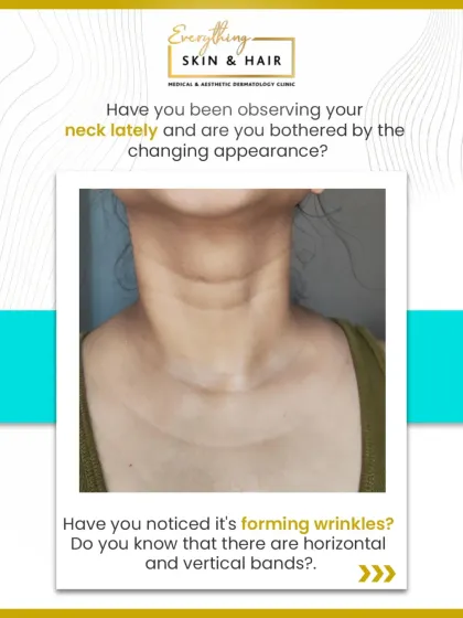 The neck is one of the first areas to show signs of aging, with both horizontal lines and vertical bands becoming more prominent. I believe in a comprehensive approach, treating the neck with the same attention to detail as the face to ensure a harmonious and youthful result.