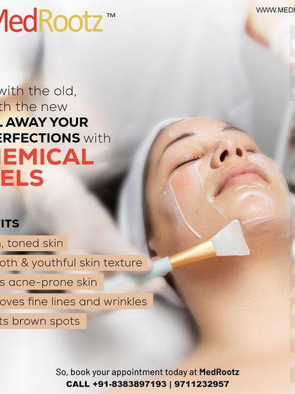 Peels are a great way to treat brown spots and improve fine lines. They help create a smoother, more youthful skin texture and are particularly helpful for those with acne-prone skin.