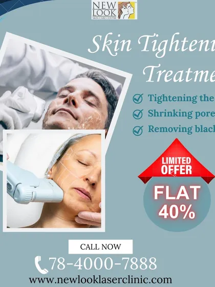We offer targeted skin tightening treatments using advanced devices. These procedures are designed to firm the skin, shrink enlarged pores, and improve the appearance of surface-level marks for a smoother finish.