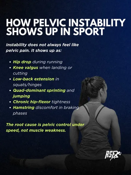 Pelvic instability doesn't always feel like pelvic pain. It often shows up as a hip drop during running, knee valgus when landing, chronic hip-flexor tightness, or hamstring discomfort, all stemming from a lack of control under speed.