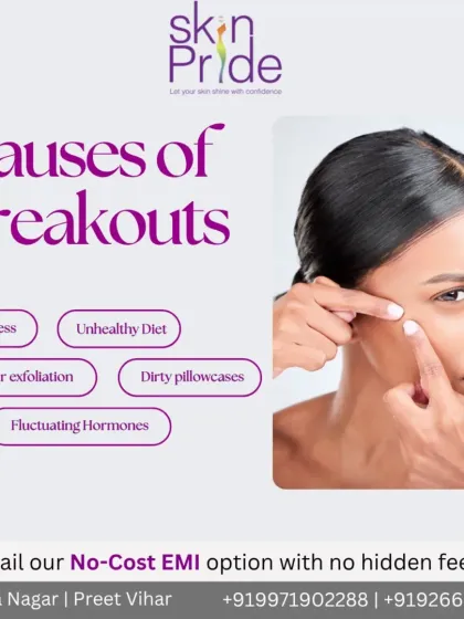 Understanding the causes of breakouts is the first step to treating them. Stress, diet, and hormones can all play a role.
