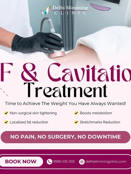 This graphic explains our RF and Cavitation treatment, a non-surgical solution for body contouring. It helps with localized fat reduction, boosts metabolism, and tightens skin to reduce stretch marks without pain or downtime.