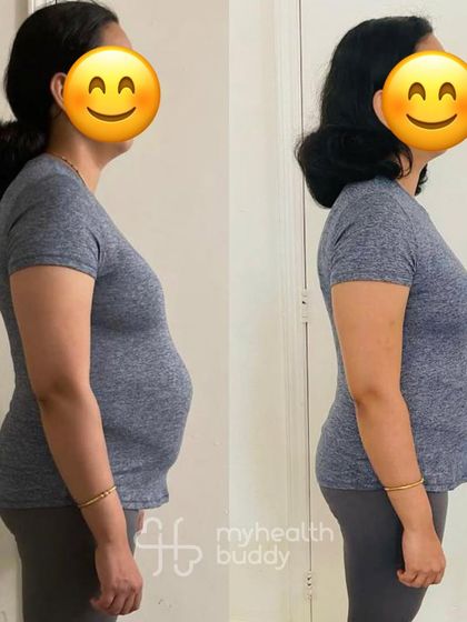 This client not only lost fat but also healed her Diastasis Recti gap. Her measurements show a significant reduction in the gap's width and depth, proving that targeted exercises can make a real difference in postpartum recovery.