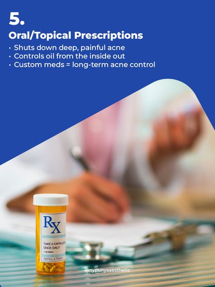 For deep, painful, or persistent back acne, oral or topical prescriptions are often necessary. These custom medications work from the inside out to control oil production and shut down inflammation for long-term control.