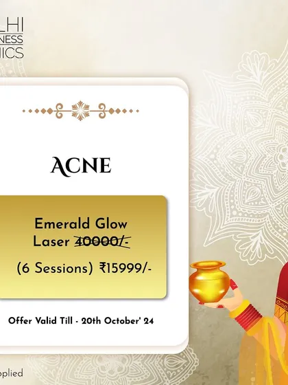 Our Karwa Chauth offer on the Emerald Glow Laser treatment for acne, including six sessions at a special festive price.