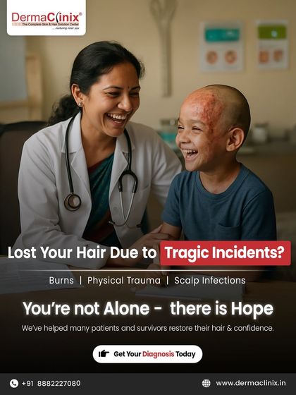 Hair loss can occur due to tragic incidents like burns, physical trauma, or scalp infections. We have helped many survivors restore their hair and confidence through specialized scar concealment and hair restoration procedures.