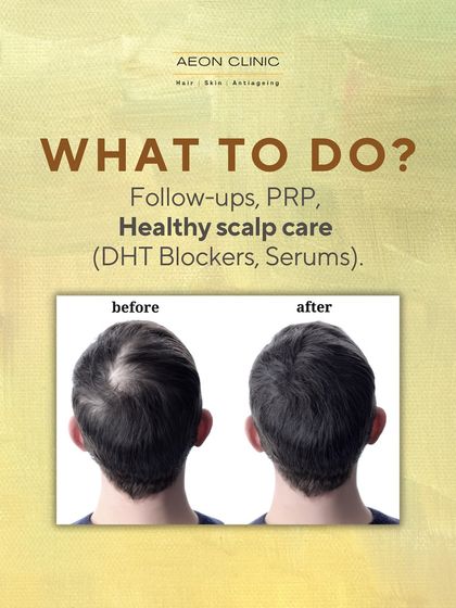To maintain your overall hair health post-transplant, we recommend follow-ups, supportive treatments like PRP, and a good scalp care routine with DHT blockers and serums.