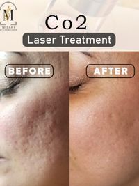 Advanced Facials & Skin Rejuvenation