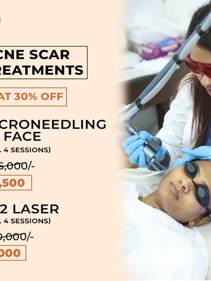 Address acne scars with our February offers. Get a flat 30% off on Microneedling RF and CO2 Laser packages to help smooth and resurface your skin.