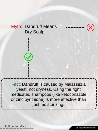 One of the biggest myths about dandruff is that it's caused by a dry scalp. In reality, it's caused by a yeast called Malassezia that thrives on oily scalps. This is why using the right medicated shampoos with ingredients like ketoconazole is far more effective than just moisturizing.