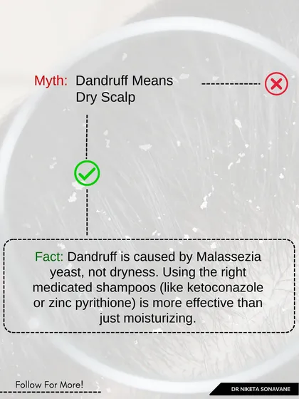 One of the biggest myths about dandruff is that it's caused by a dry scalp. In reality, it's caused by a yeast called Malassezia that thrives on oily scalps. This is why using the right medicated shampoos with ingredients like ketoconazole is far more effective than just moisturizing.