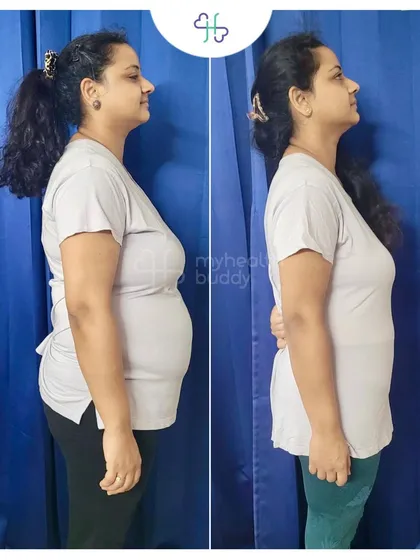 As a full time working mother of two, this client learned that consistency and self love are key. She lost 9 kgs in 6 months by following a flexible plan that fit her busy life, and she never doubted herself.