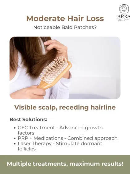 When you can see your scalp or your hairline is visibly receding, it's a sign of moderate hair loss. At this stage, a combined approach using advanced growth factors like GFC, PRP, and laser therapy can stimulate dormant follicles and deliver maximum results.