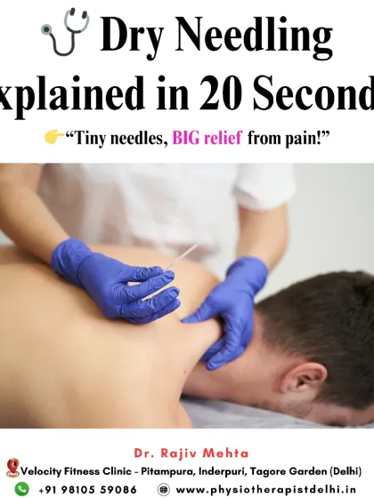 Dry Needling is an advanced technique I use to release trigger points and relieve muscle pain. It involves using tiny, sterile needles to target knotted muscles, which can provide significant relief for chronic conditions and sports injuries.