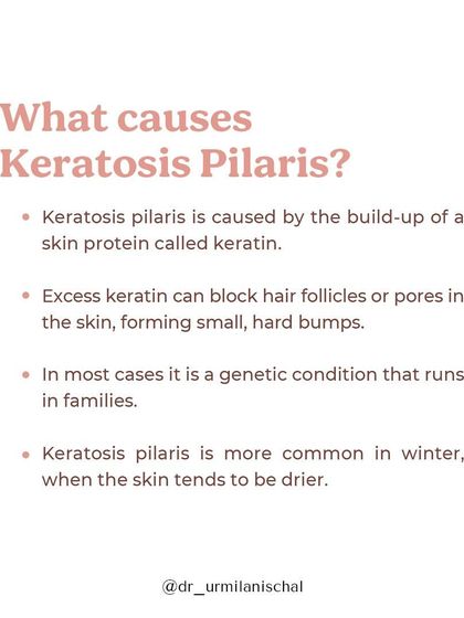 Urmila Nischal - Medical Dermatology Body & Specialized Skin Concerns photo 19