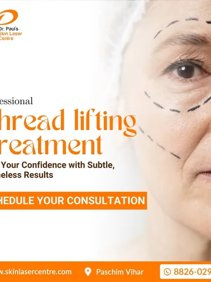 An illustration of where a professional thread lifting treatment can be applied. This procedure helps lift your confidence by providing subtle, timeless results for a refreshed appearance.