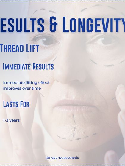 One of the biggest advantages of a thread lift is the immediate lifting effect, which continues to improve over time as collagen is produced. The results can last for 1 to 3 years.