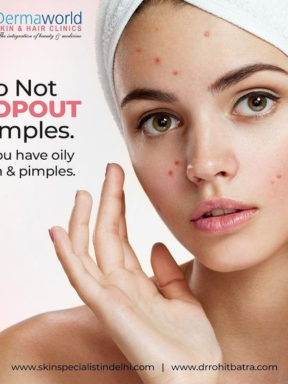 It is very tempting to pop a pimple, especially if you have oily, acne-prone skin. However, this action damages the surrounding tissue and can turn a small spot into a long-lasting scar or dark mark. It is always better to let it heal or get it professionally treated.