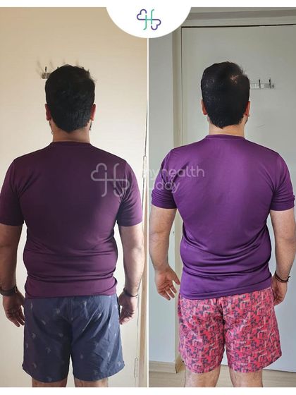 Back view of Anshul's progress.