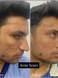 Advanced Skincare Treatments