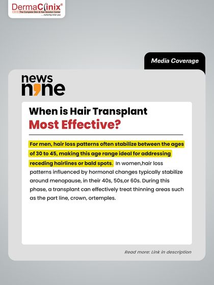 When is a hair transplant most effective? For men, it is often between 30 and 45 when hair loss stabilizes. For women, it is often around menopause. We provide honest advice based on your individual situation.