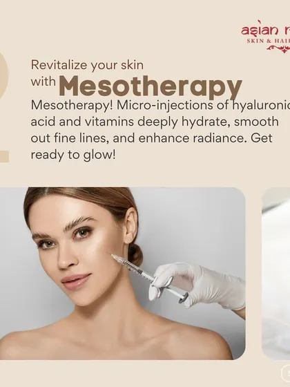 Mesotherapy is an excellent option for revitalizing the skin. It involves micro-injections of hyaluronic acid and vitamins to deeply hydrate, smooth fine lines, and enhance radiance, getting you ready to glow.