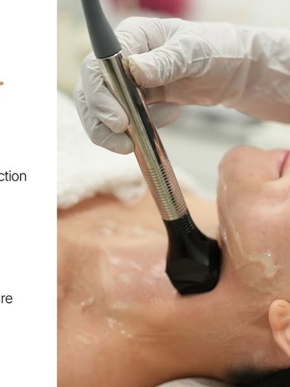 This graphic highlights the key benefits of a Forma Face treatment. It tightens and lifts the skin, stimulates collagen, defines facial contours, and improves overall texture and firmness.