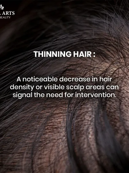 Sign: Thinning hair. A noticeable decrease in hair density or visible scalp areas is a clear signal for intervention. PRP helps improve hair density for a fuller look.