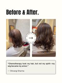 Hair Loss Solutions (Wigs & Toppers)