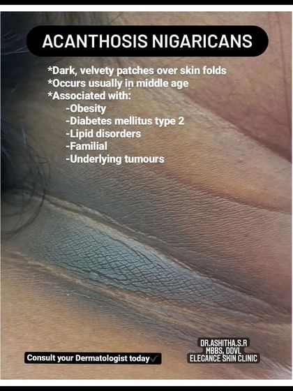 Elegance Skin Clinic - Clinical Dermatology Addressing Pigmentation and Uneven Tone photo 3