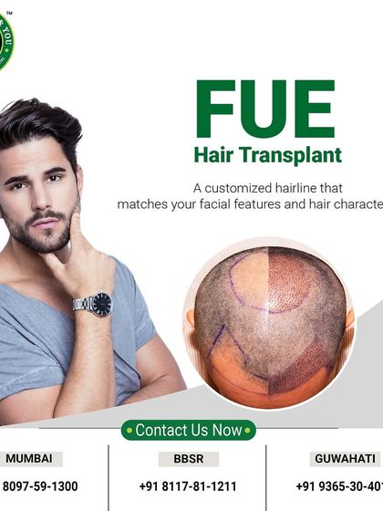 My FUE hair transplant technique focuses on creating a customized hairline that perfectly matches your unique facial features and hair characteristics, ensuring a result that looks like it was always there.