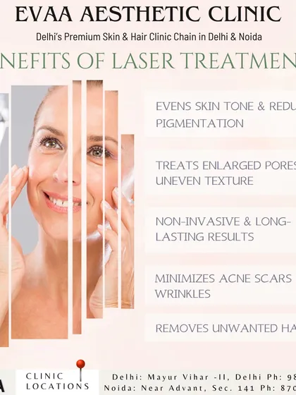 This graphic summarizes the broad benefits of laser treatments, including evening skin tone, treating enlarged pores, minimizing acne scars, and removing unwanted hair.