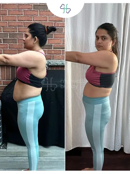 Side view of Ruchika's transformation, highlighting the change in her midsection.