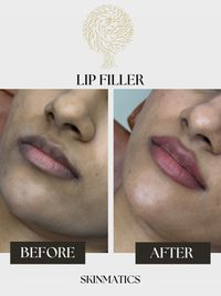 Facial Aesthetics & Anti-Aging