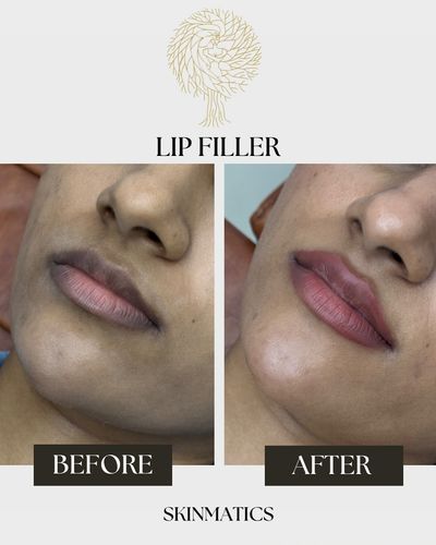 Facial Aesthetics & Anti-Aging
