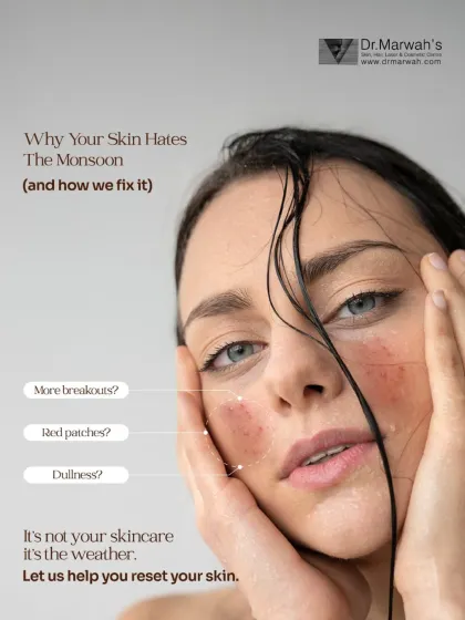 This image highlights the common skin issues faced during the monsoon: more breakouts, red patches, and dullness. It's not your skincare failing; it's the weather, and we can help reset your skin.