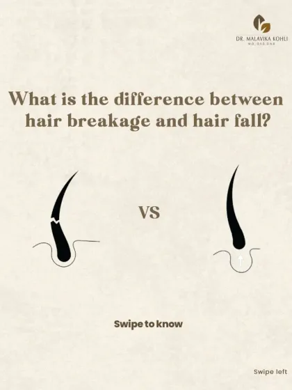 Understanding the difference between hair fall from the root and hair breakage along the shaft is the first step in a correct diagnosis. This distinction is critical as it dictates the entire course of treatment, ensuring we address the true underlying cause of your hair concern.