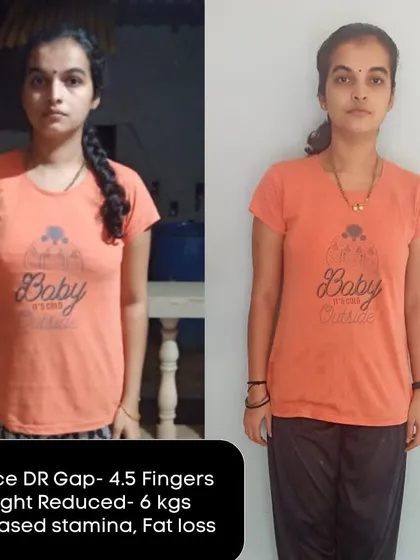 This client reduced her DR gap by 4.5 fingers and lost 6 kgs, all while increasing her stamina. This is holistic fitness in action.