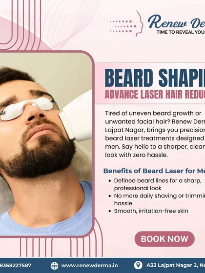 Men, if you are tired of the daily hassle of shaving to maintain your beard, this is for you. Our laser beard shaping gives you permanently defined, sharp lines for a clean, professional look. It's a simple way to make life easier.