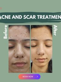 Advanced Skin Correction