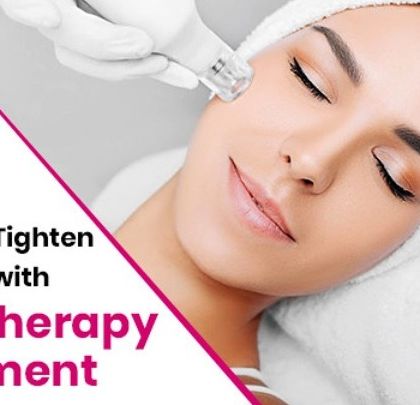 Mesotherapy is a treatment where I inject a cocktail of vitamins and nutrients into the skin to restore and tighten it. It's a great option for overall skin rejuvenation and hydration.