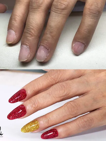 The power of a great manicure. This before-and-after shows how I can transform natural nails with extensions and glitter gel polish, creating a glamorous and festive look.
