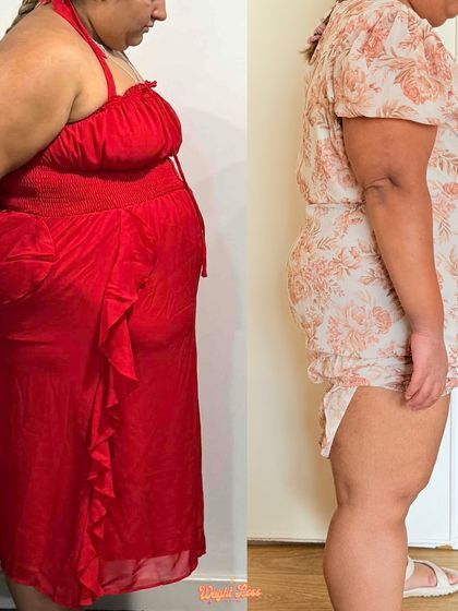 Anjali's side profile transformation. Her story is proof that a health diagnosis can be a powerful catalyst for change, and you don't have to do it alone.