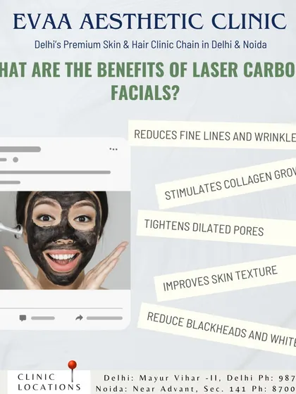 This infographic details the benefits of our Laser Carbon Facials, which include reducing fine lines, stimulating collagen growth, tightening pores, and improving overall skin texture.